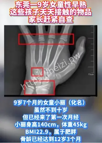 儿童性早熟身高受损